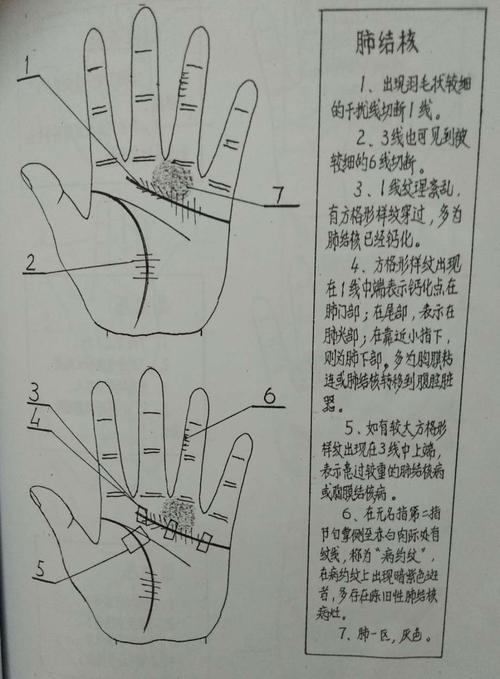 掌握掌纹医学破解健康密码!《掌纹医学知识》每天三分钟李桂英