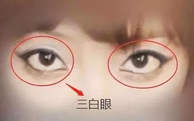 在中国人的面相中但是眼型就有很多类不过要说起三白眼许多人对他