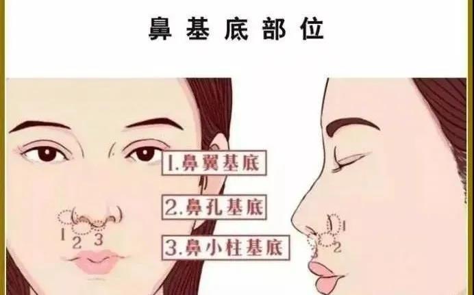 如何改善鼻基底凹陷