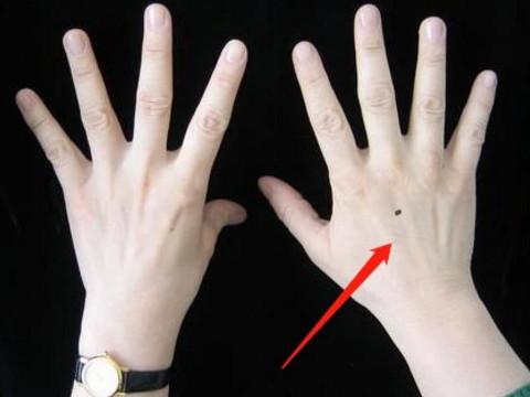 手背长痣的位置图解 左手和右手手背长痣代表着什么
