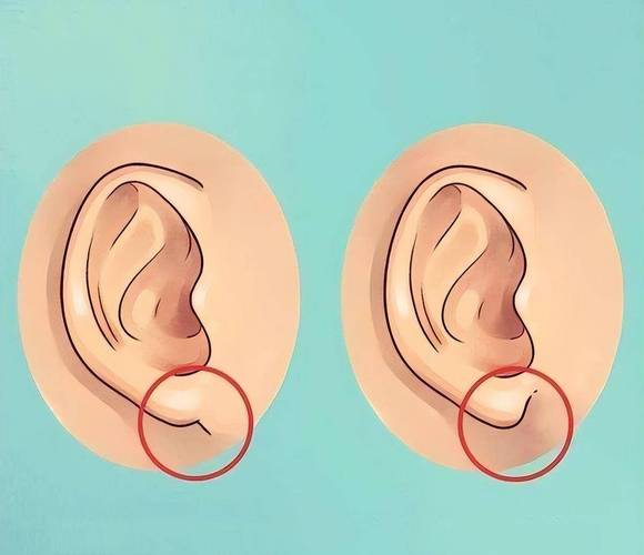 耳朵不同命不同?自测看看你是哪种耳型?_耳垂_面相_生活
