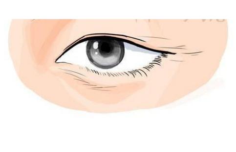 鹊眼指的是眼睛整体比较细长但上下眼皮有许多细纹的眼睛.