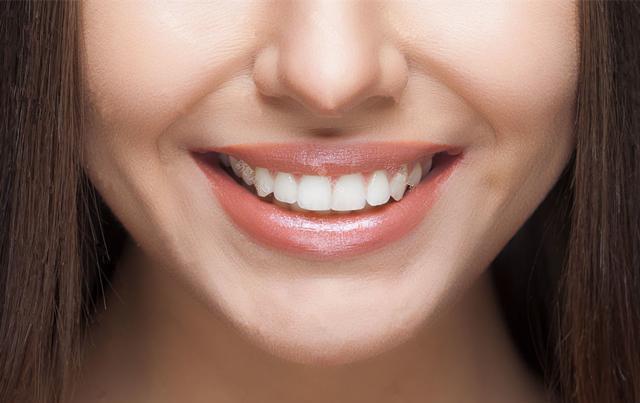 牙的好坏还会影响事业感情运势? ——《柳庄神相·相牙》