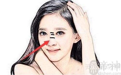 女人鼻梁有横纹面相看运势注意出行和健康