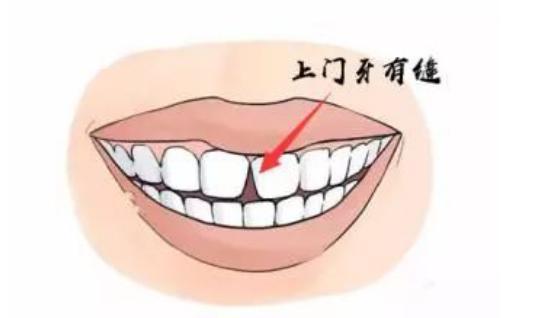 上牙代表父母下牙代表儿女牙齿影响运势? - my命理学