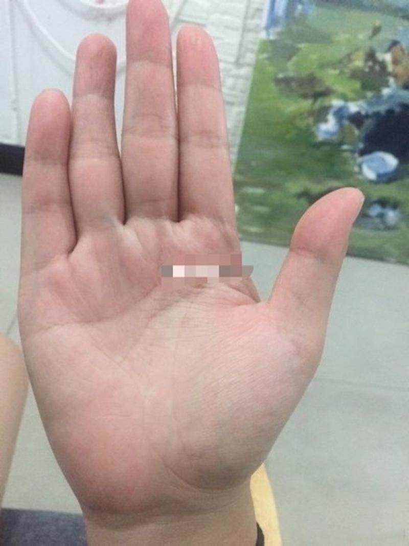 手相预测#从手掌中看无名指偏离中指较远则代表你和伴侣之间的隔阂
