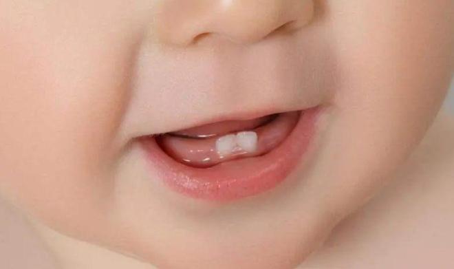 宝宝长牙早命苦乳牙应该何时长家长不要掉以轻心