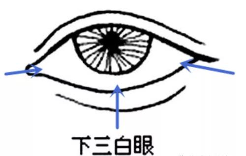 面相中三白眼一般是指眼睛白多黑少左右上方都露出眼白所以称之为上