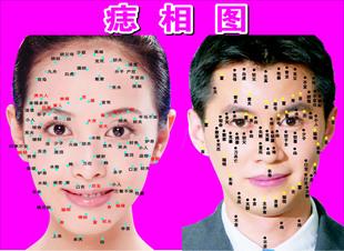 益智画g97/561男女痣相图海报展板素材宣传贴纸