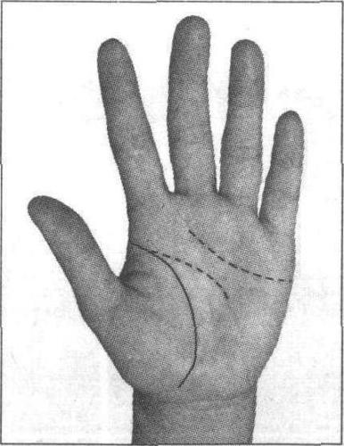 诊病实例分析 正文           也称生命线就是由手掌虎口中央起点