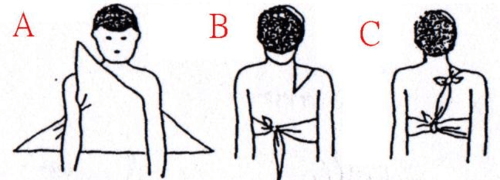 胸部或背部包扎法(使用全巾):用于胸部或背部外伤时三角巾顶点需