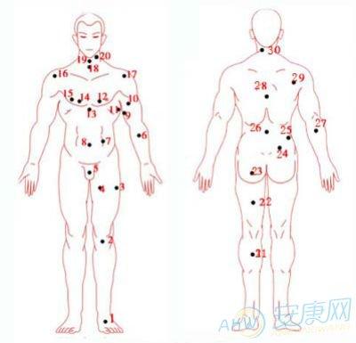 身上长痣的位置和命运身上痣的位置与命运图